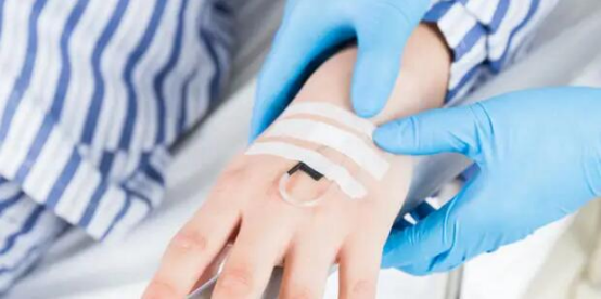 Enhancing Medical Imaging with Contrast Agent Injection and Pressure Injectors